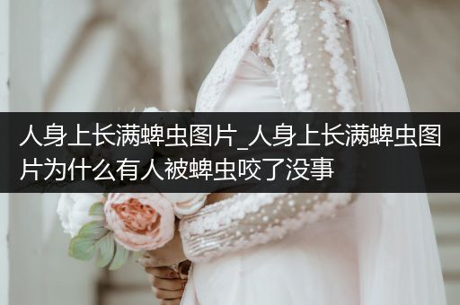 人身上長滿蜱蟲圖片_人身上長滿蜱蟲圖片為什么有人被蜱蟲咬了沒事