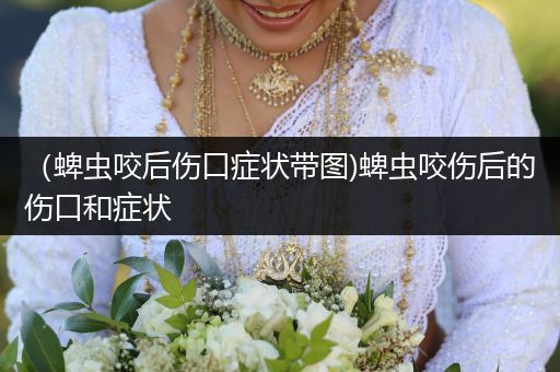 （蜱蟲咬后傷口癥狀帶圖)蜱蟲咬傷后的傷口和癥狀